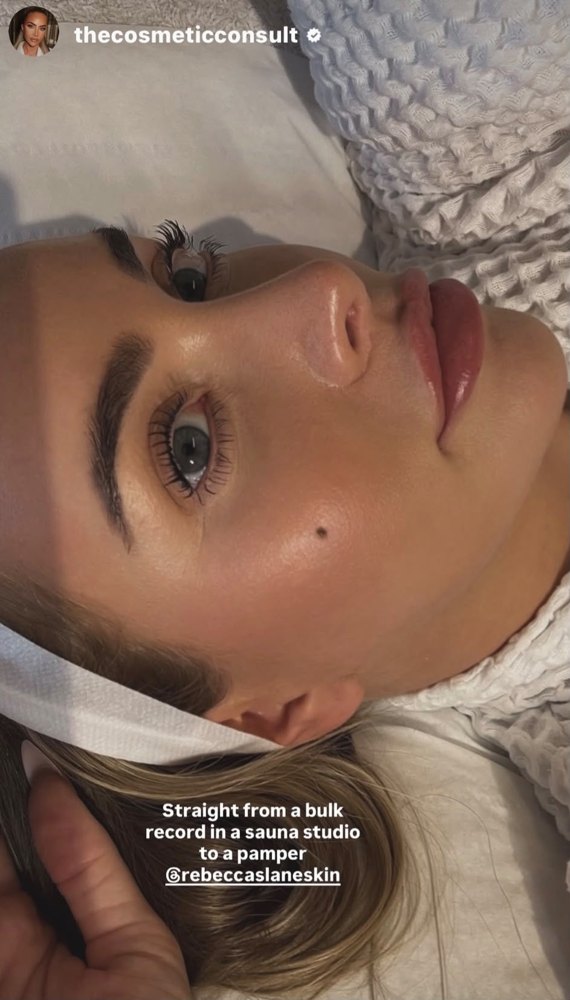 Glowing skin result at Rebecca Slane Skin