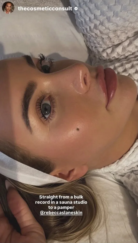 Glowing skin result at Rebecca Slane Skin