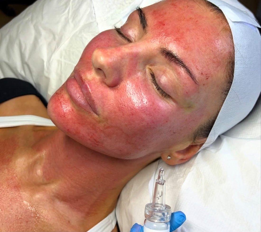 Fresh, glowing skin after treatment