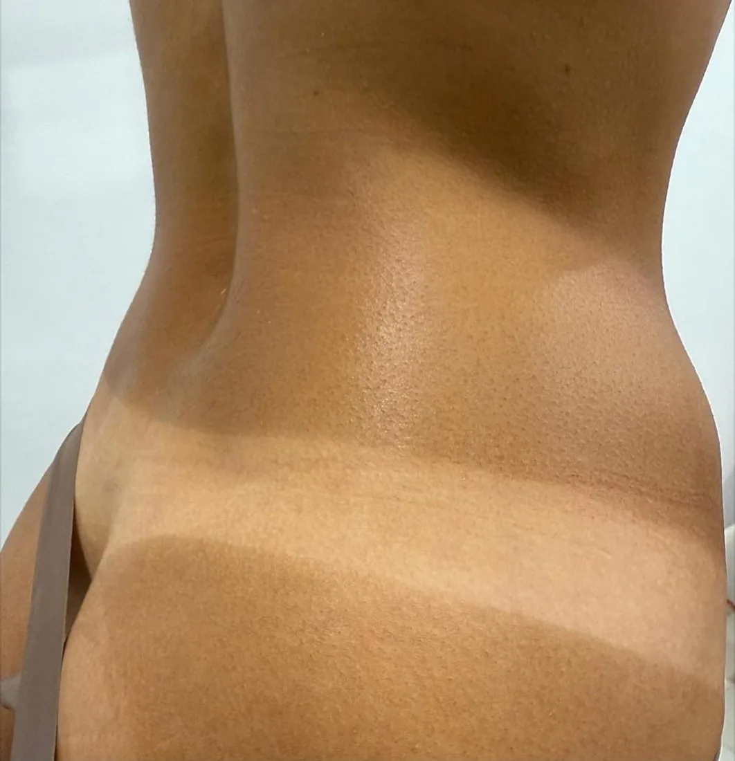 Natural-looking spray tan result