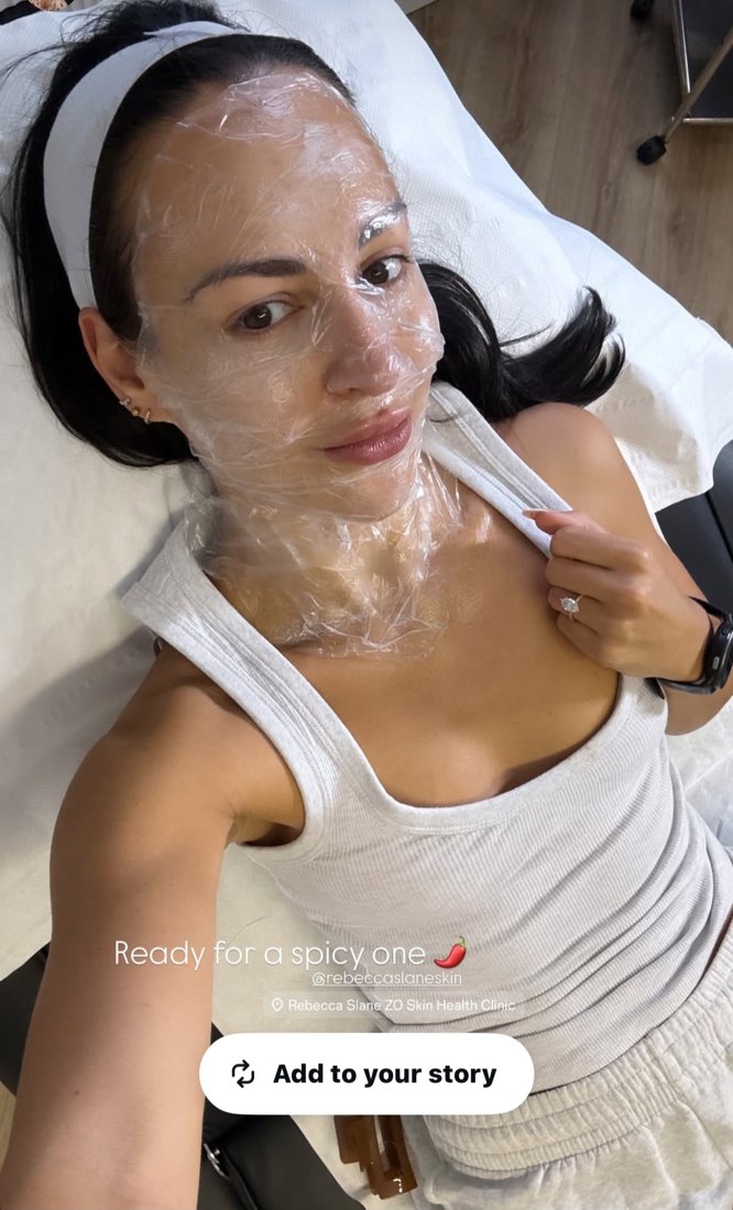 Chemical peel treatment at Rebecca Slane Skin