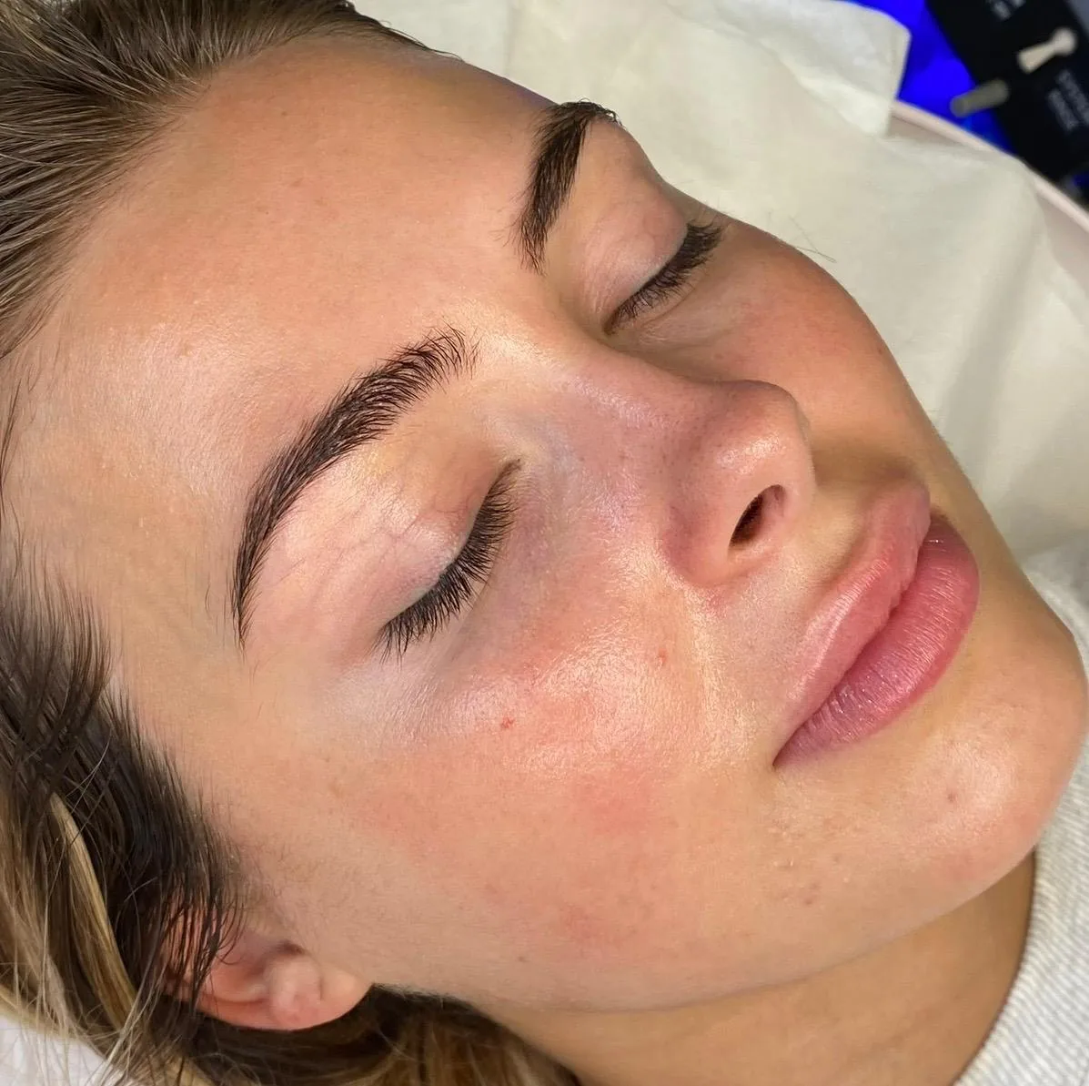 Glowing, refreshed skin after a facial