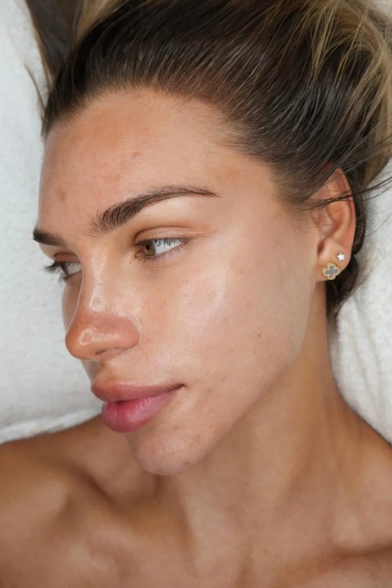 Radiant skin result