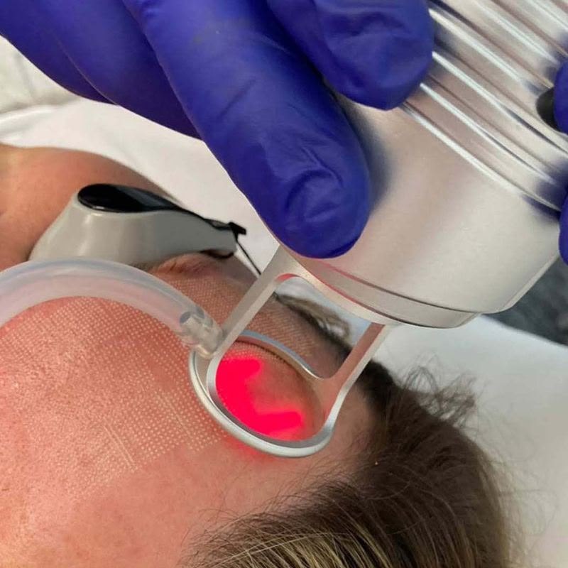 Laser light treatment