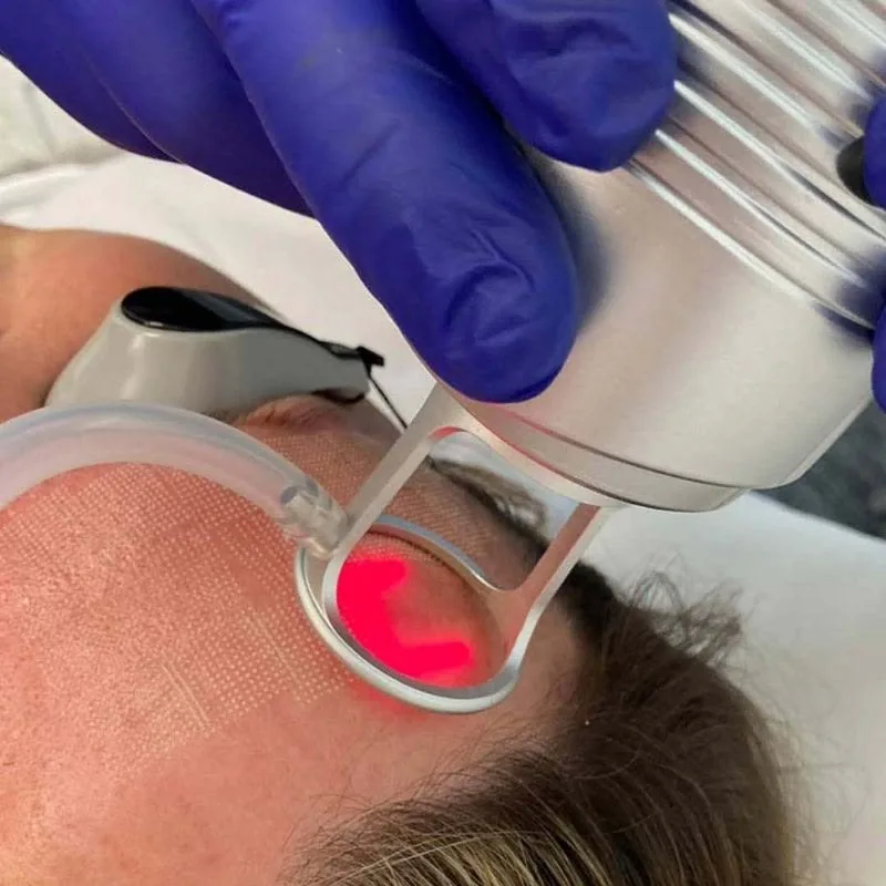 Laser light treatment